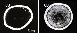 ニワトリ大腿骨横断面X線像（左:オス、右:メス）　メスでは骨髄骨（MB）が観察される。
