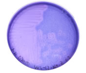 キチン含有寒天培地でキチン分解細菌を培養した様子。<br />キチンを特殊な色素で青く染めると、細菌がキチンを分解している様子がよくわかります。